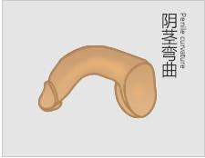 男性必看：导致阳具变弯的原因