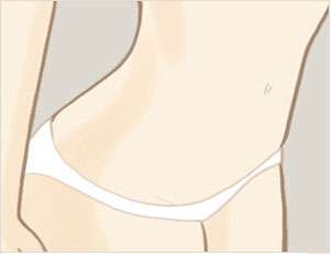 人造处女膜