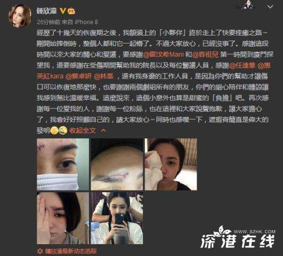 阿娇晒伤口照片 伤口有多严重？什么情况？