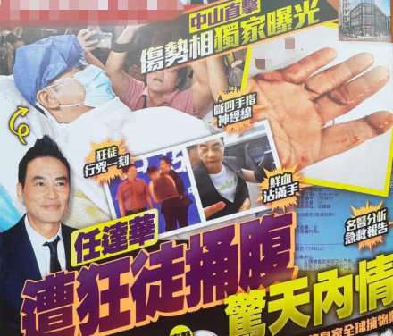 任达华拒绝主办方的赔偿 问到伤势妻子称恢复良好