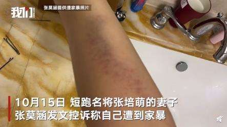 张培萌妻子称只想要女儿抚养权 具体什么情况？？