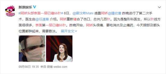阿娇头部表面一层已缝66针 阿娇的伤情目前什么情况？